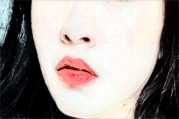 哈爾濱醫(yī)科大學附屬第一醫(yī)院光子嫩膚怎么樣【光子嫩膚案例】