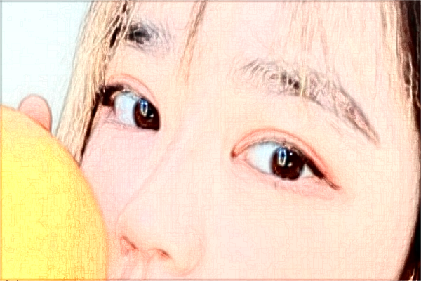 哈爾濱醫(yī)科大學(xué)附屬第一醫(yī)院近視手術(shù)做的好嗎_案例+價格