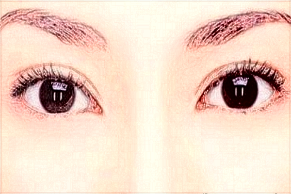 哈爾濱醫(yī)科大學(xué)附屬第一醫(yī)院近視手術(shù)做的好嗎_案例+價格