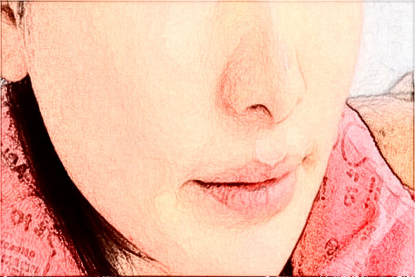 阜陽市人民醫(yī)院祛痘做的好不好_醫(yī)生技術(shù)怎么樣