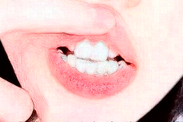 2024徐州市中心醫(yī)院種植牙做的好嗎_誰(shuí)做的比較好