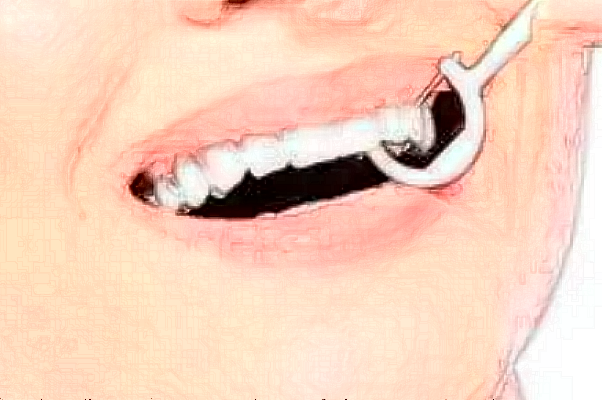 2024徐州市中心醫(yī)院種植牙做的好嗎_誰(shuí)做的比較好