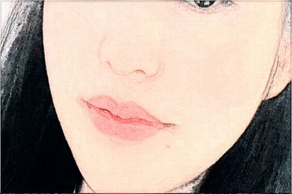 哈爾濱醫(yī)科大學(xué)附屬第一醫(yī)院去疤做的好嗎_案例+價(jià)格