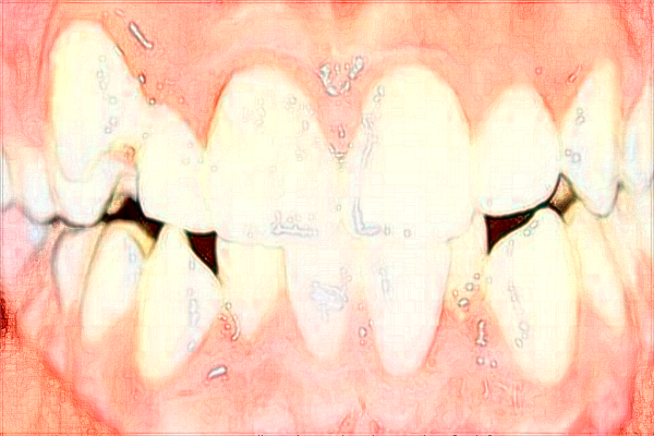 中山大學附屬第一醫(yī)院牙科哪個醫(yī)生好?牙齒矯正好嗎