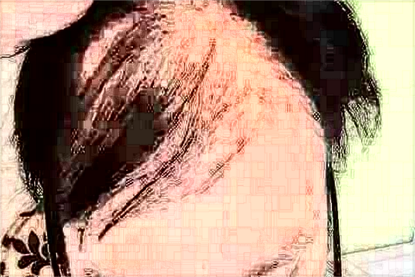 中山大學(xué)附屬第一醫(yī)院植發(fā)掛什么科?植發(fā)后注意事項(xiàng)