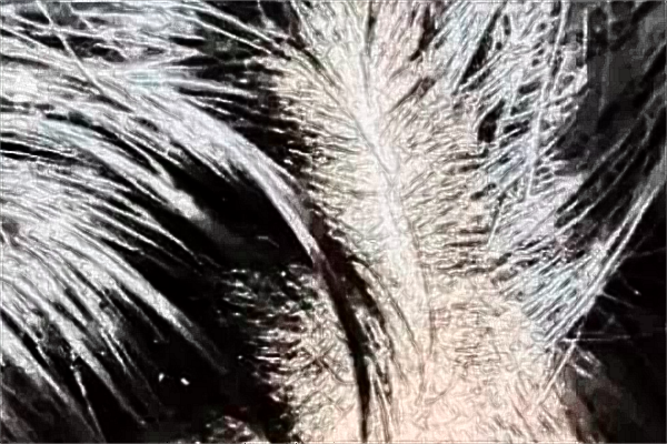 中山大學(xué)附屬第一醫(yī)院植發(fā)怎么樣?2024植發(fā)價(jià)格