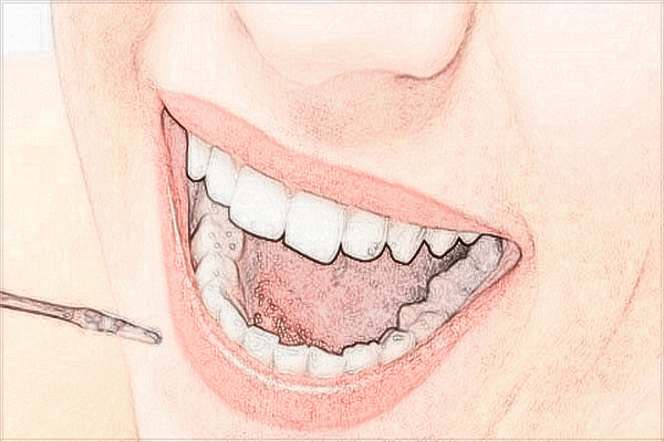 2024中山大學附屬口腔醫(yī)院牙齒矯正哪個醫(yī)生好?收費多少?