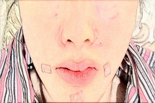 2024阜陽市人民醫(yī)院整形美容外科怎么樣？2024醫(yī)生介紹