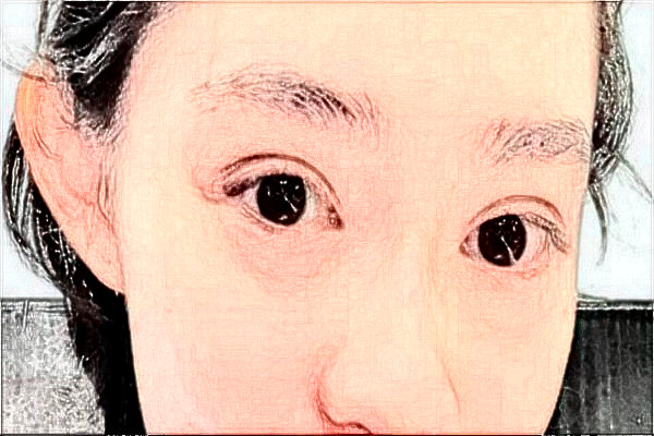 2024臺(tái)州醫(yī)院飛秒做的好嗎_誰(shuí)做的比較好