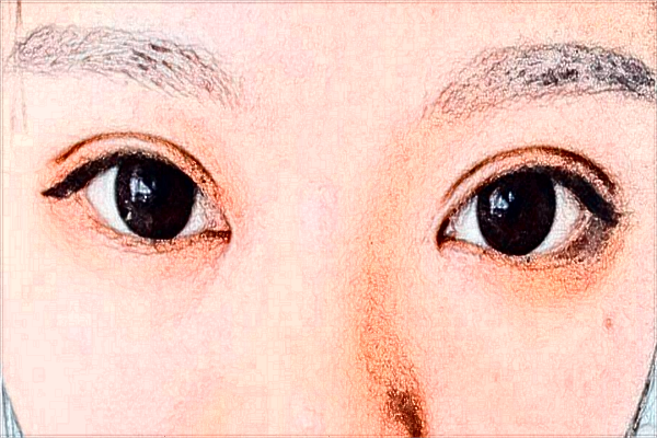 徐州市中心醫(yī)院整形美容科醫(yī)生簡(jiǎn)介_(kāi)價(jià)目表分享