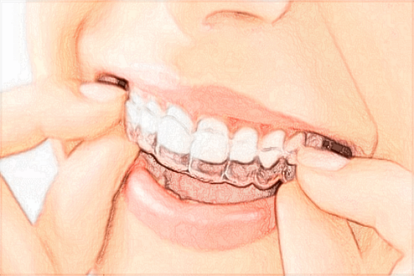 2024泉州180醫(yī)院牙科收費(fèi)價目表?牙科醫(yī)生怎么樣