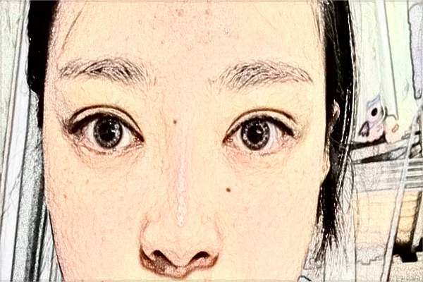 2024天津人民醫(yī)院激光祛斑怎么樣？案例價(jià)格一覽