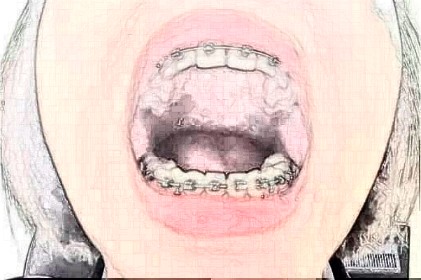 蘇州牙科醫(yī)院排行榜前五強揭曉!2024哪家技術(shù)好？