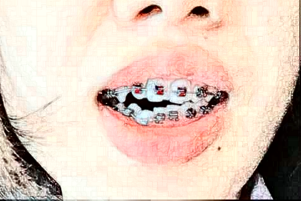 蘇州牙科醫(yī)院排行榜前五強揭曉!2024哪家技術(shù)好？