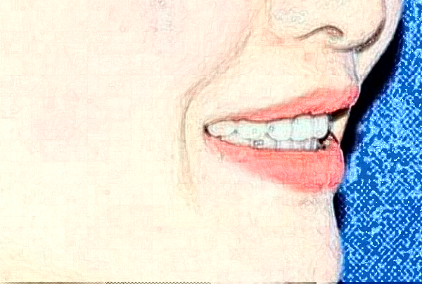 天津市口腔醫(yī)院根管多少錢_做的好嗎？