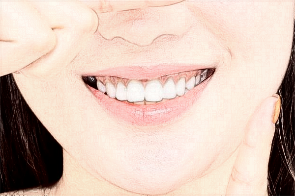 廣東省中醫(yī)院珠海醫(yī)院拔牙疼不疼?拔牙幾天才能恢復(fù)