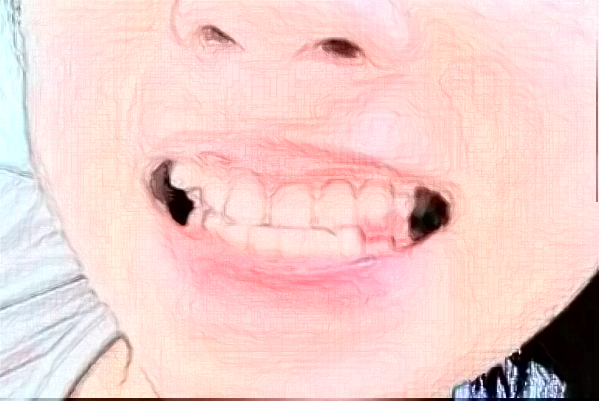 2024天津人民醫(yī)院牙科貴嗎？牙科收費(fèi)標(biāo)準(zhǔn)