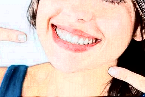 2024哈爾濱242醫(yī)院口腔科烤瓷冠做的好嗎？哪位醫(yī)生做的好