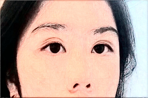 2024哈爾濱醫(yī)科大學(xué)附屬第二醫(yī)院全飛秒多少費(fèi)用？醫(yī)生推薦