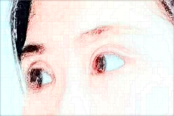 2024蘇州第四人民醫(yī)院近視手術做的好嗎？哪位醫(yī)生做的好