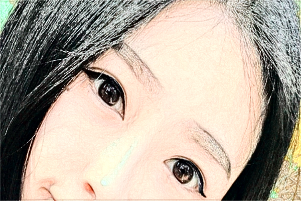 蘇州第四人民醫(yī)院激光去紅血絲多少費用？醫(yī)生排名