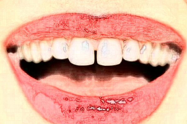 天津市口腔醫(yī)院牙冠哪個(gè)醫(yī)生好_專家案例