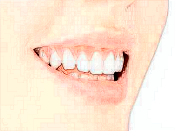 中山大學(xué)附屬口腔醫(yī)院洗牙怎么樣?洗牙對牙齒有傷害嗎