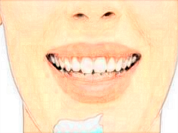 中山大學(xué)附屬口腔醫(yī)院洗牙怎么樣?洗牙對牙齒有傷害嗎