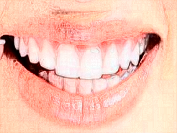 中山大學(xué)附屬口腔醫(yī)院口腔修復(fù)科治什么?可以補(bǔ)牙嗎?