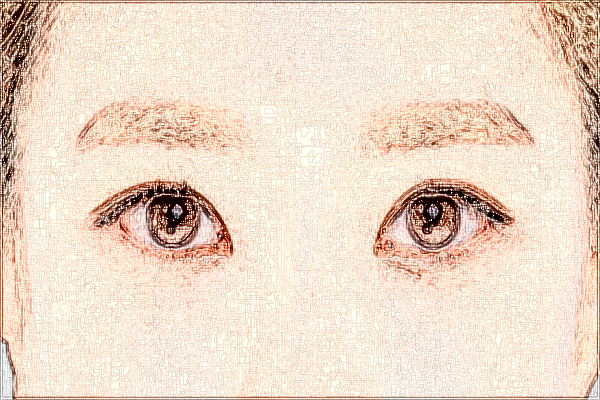 惠州市中心人民醫(yī)院做近視手術(shù)應(yīng)該掛什么科?近視手術(shù)費(fèi)用