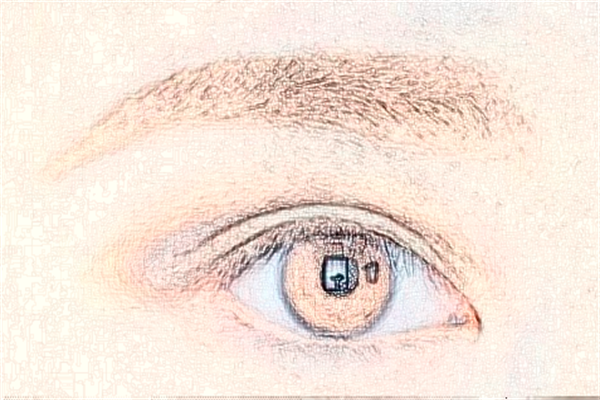 2024泉州180醫(yī)院近視激光手術(shù)多少錢?近視激光手術(shù)是什么