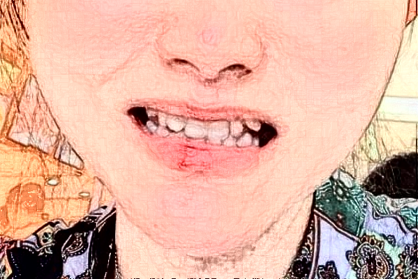 2024常州市第三人民醫(yī)院口腔科牙齒修復(fù)誰(shuí)做得好_醫(yī)生簡(jiǎn)介