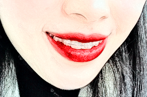 2024江蘇大學附屬醫(yī)院種牙做的好嗎_種牙后注意事項有哪些