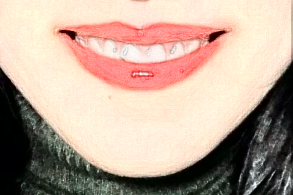 2024天津醫(yī)院口腔科種植牙怎么樣_誰做得好