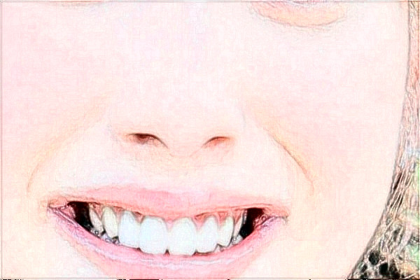 2024阜陽(yáng)市人民醫(yī)院激光脫毛價(jià)格多少？做的怎么樣