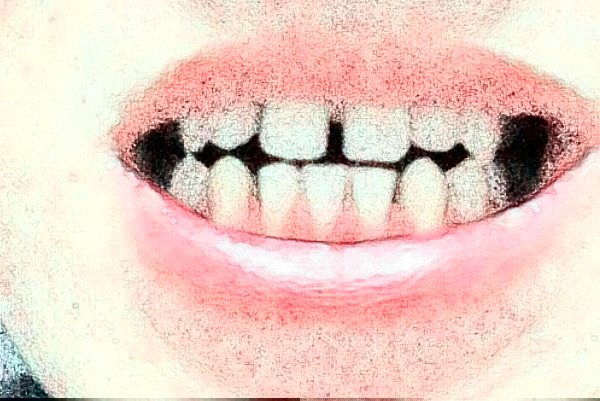 2024天津醫(yī)科大學第二醫(yī)院口腔科反牙合正畸價目表(價格表)怎么樣