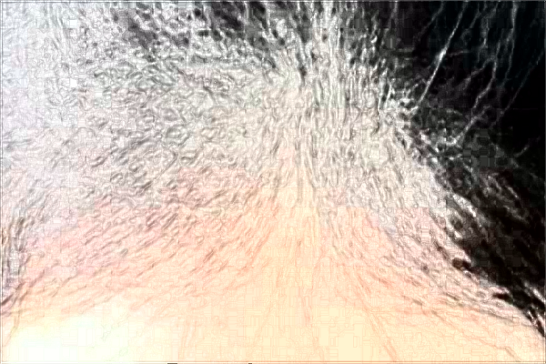 江蘇大學(xué)附屬醫(yī)院植發(fā)怎么樣_哪個醫(yī)生比較好