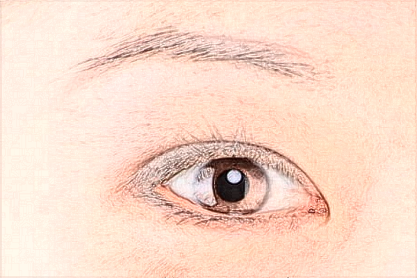 2024惠州市中心人民醫(yī)院全飛秒多少錢(qián)?全飛秒的弊端