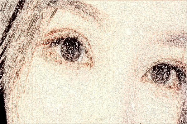 2024泉州180醫(yī)院近視激光手術(shù)價(jià)格?近視激光手術(shù)危害