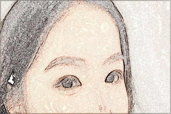 2024泉州180醫(yī)院近視激光手術(shù)價(jià)格?近視激光手術(shù)危害