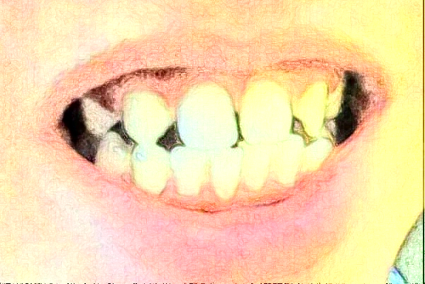 2024常州市第三人民醫(yī)院口腔科鑲牙價(jià)目表(價(jià)格表)怎么樣