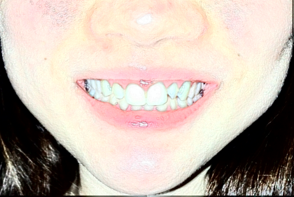 金華市中醫(yī)院口腔科牙體牙髓好嗎？牙體牙髓要多少錢