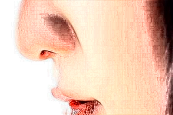 南京鼓樓醫(yī)院熱拉提做的好嗎？誰(shuí)做的好