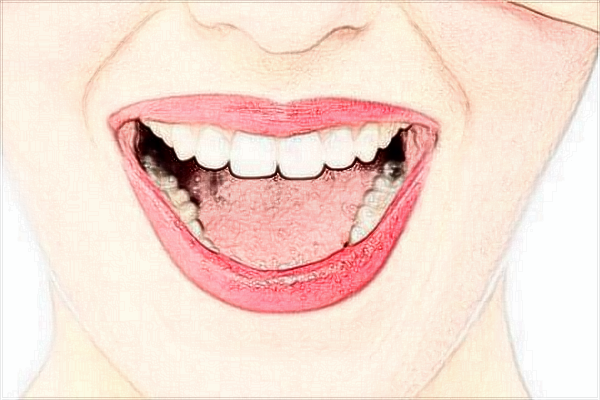 2024中山大學附屬口腔醫(yī)院種植牙怎么樣?種植牙的價格一覽表