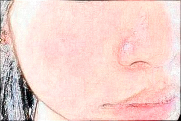 上海東方醫(yī)院祛斑價(jià)目表(價(jià)格表)怎么樣