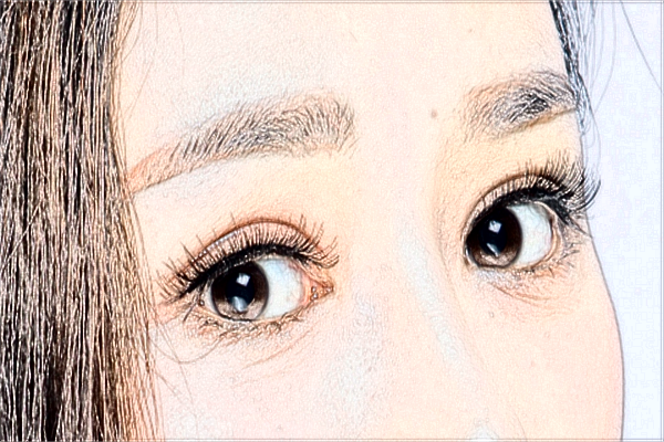 河北省人民醫(yī)院割雙眼皮做的怎么樣_哪位醫(yī)生技術(shù)比較好