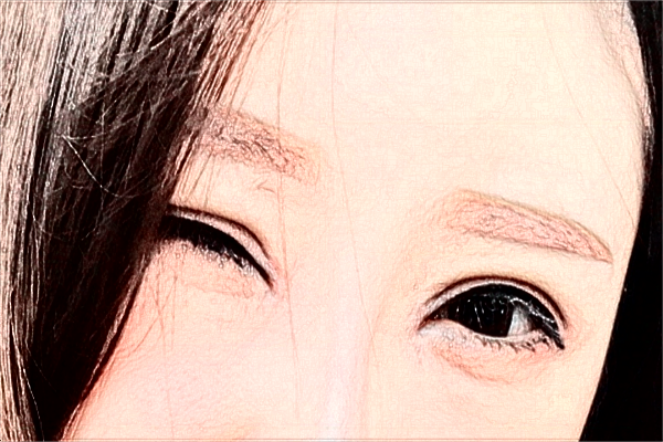 河北省人民醫(yī)院光子嫩膚M22費用多少_醫(yī)生名單