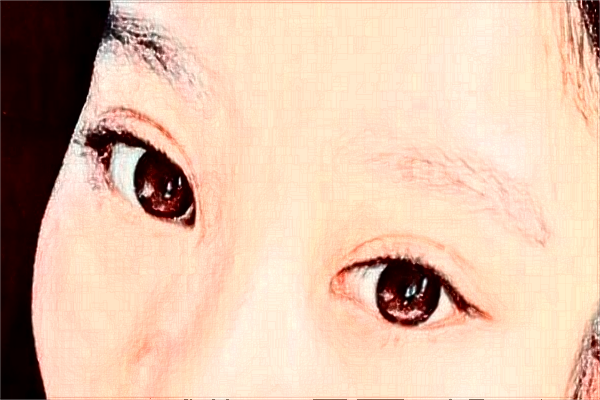 河北省人民醫(yī)院光子嫩膚M22費用多少_醫(yī)生名單