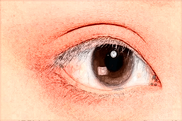 2024蘇州雙眼皮醫(yī)院排名榜前三?醫(yī)院訊息全了解