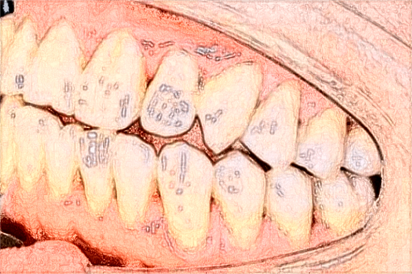 貴陽(yáng)醫(yī)學(xué)院附屬醫(yī)院牙科專家哪個(gè)好?牙齒矯正比較好的醫(yī)生